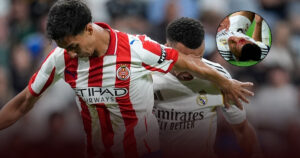 Alvaro Arbeloa Murka ke Wasit dan VAR! Wajah Kylian Mbappe Berdarah Kena Sikut Pemain Girona? Alvaro Arbeloa Murka ke Wasit dan VAR! Wajah Kylian Mbappe Berdarah Kena Sikut Pemain Girona?