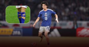 Jepang Imbang 1-1 Swedia, Insiden Kaus Kaki Robek Bikin Keito Nakamura Harus Keluar Lapangan Sementara Jepang Imbang 1-1 Swedia, Insiden Kaus Kaki Robek Bikin Keito Nakamura Harus Keluar Lapangan Sementara